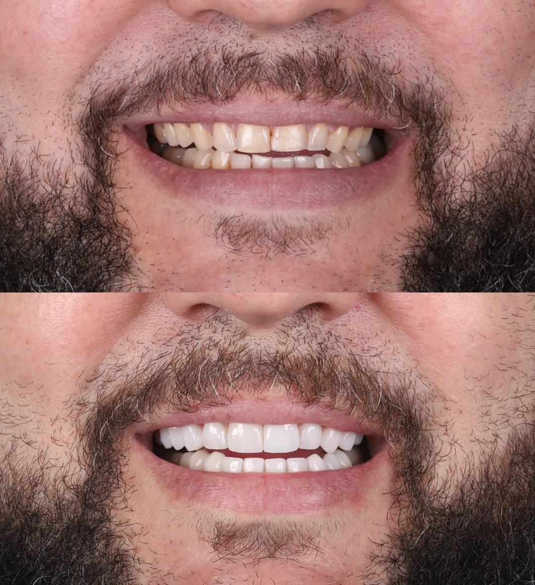 Antes e depois (2) copy