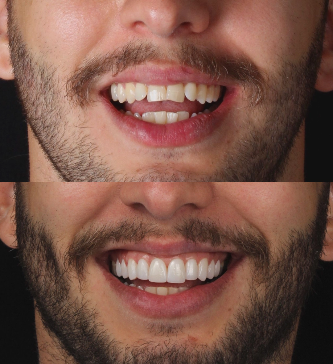 Antes e depois (3) copy