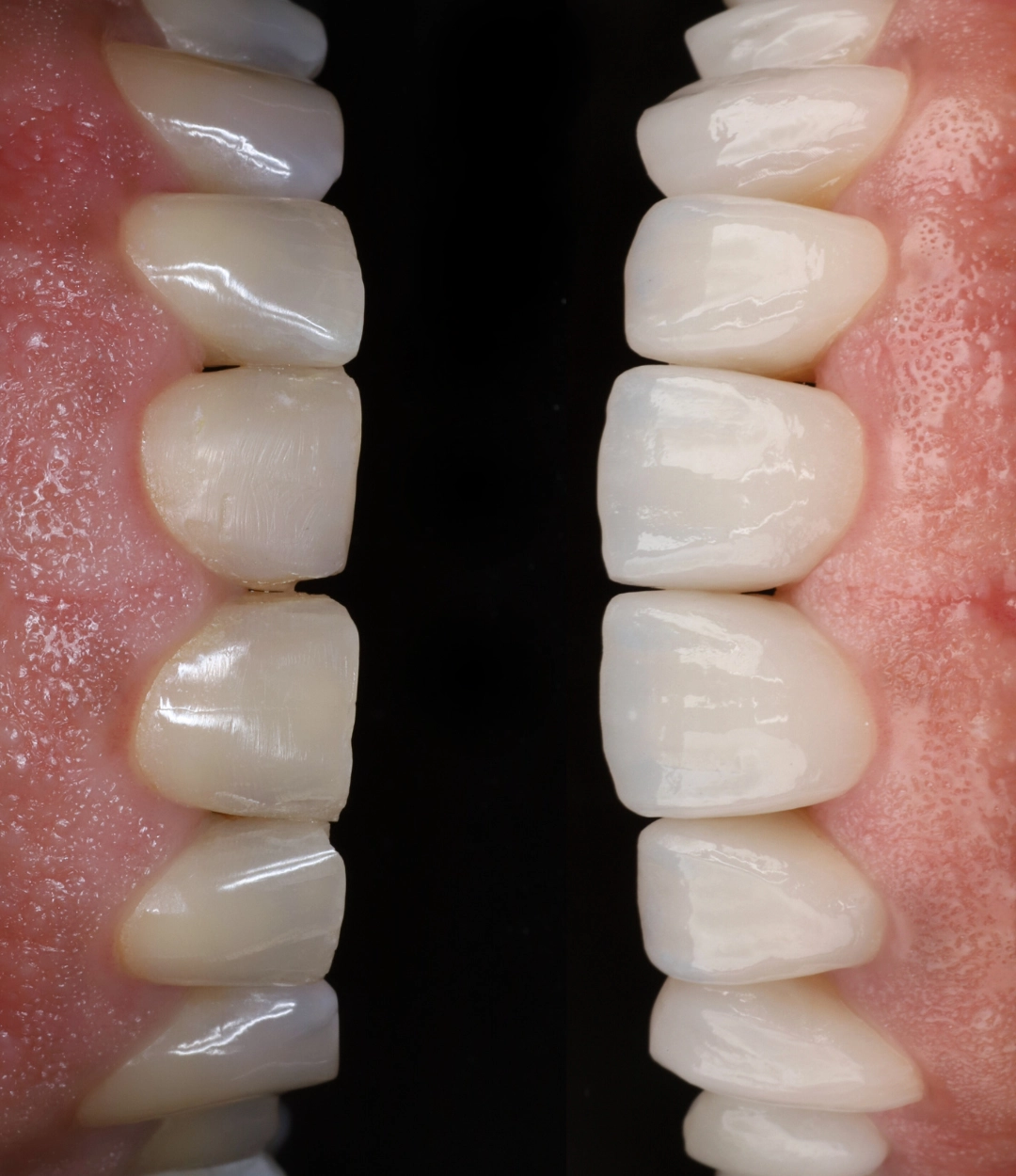 Antes e depois (4) copy