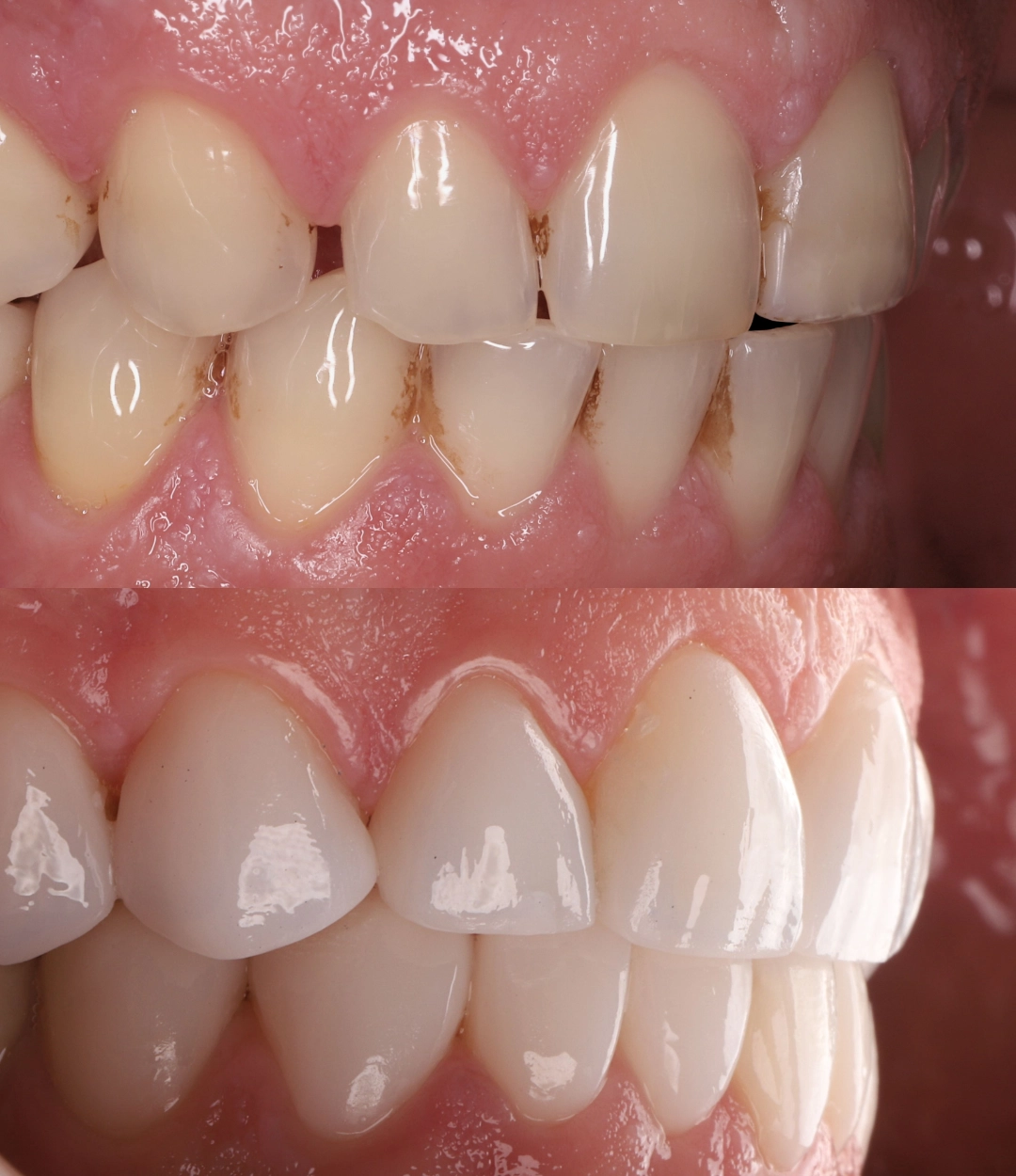 Antes e depois (5) copy