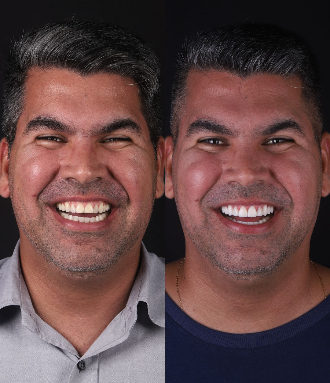 Antes e depois (6) copy